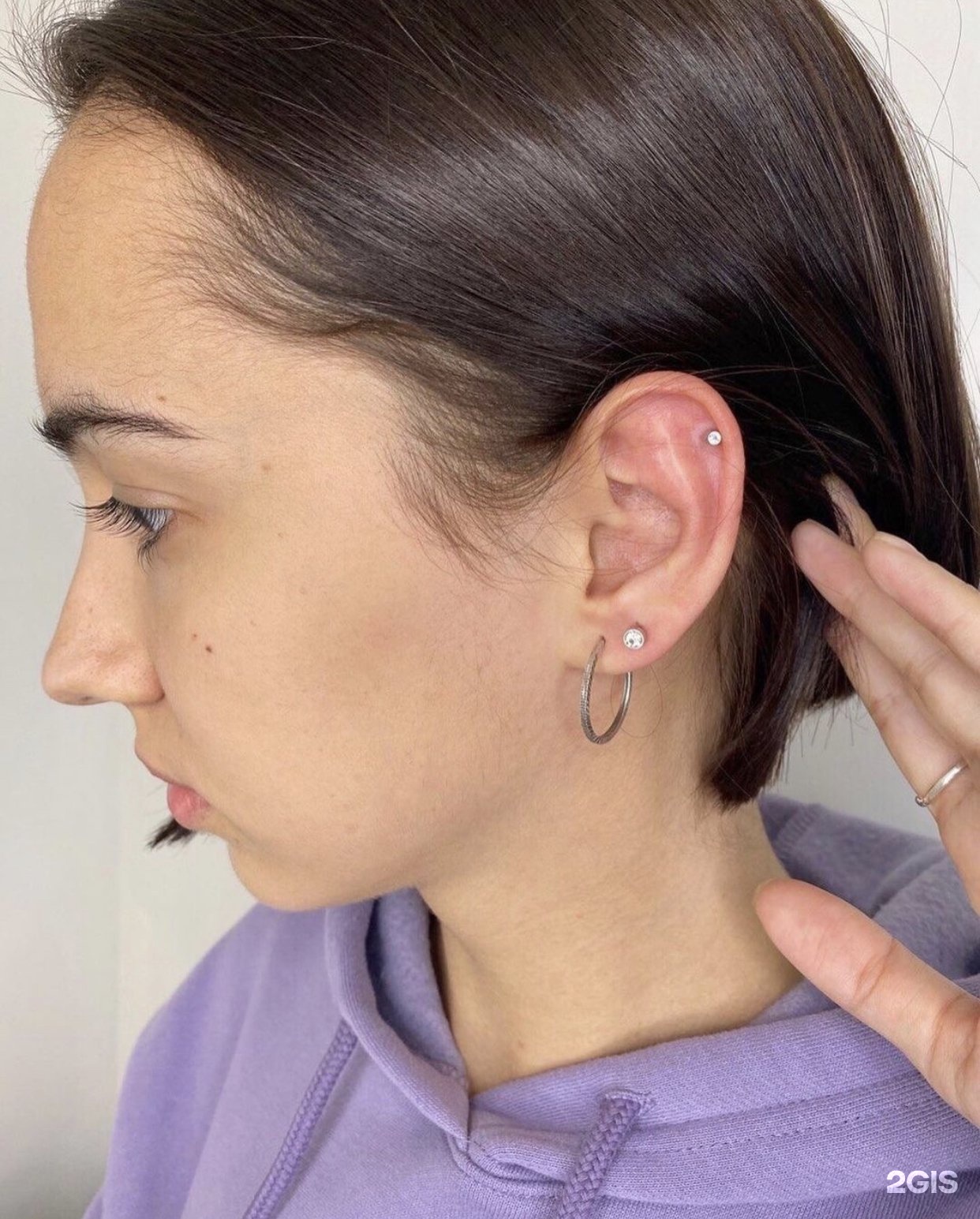 Несколько проколов в ухе. Отопластика (1 ушная раковина). Отопластика ушной раковины. Поставить на уши. Серьги на три прокола.