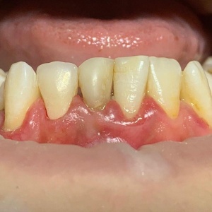 Фото от владельца ЭллаСтом, стоматологическая клиника